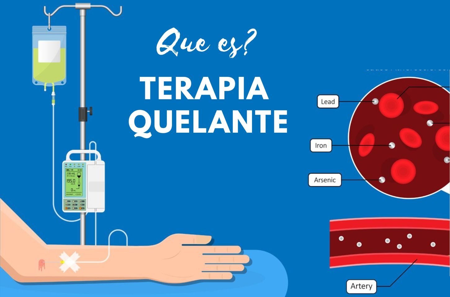 Terapia de quelación y metales pesados