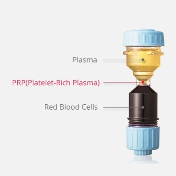 Qué es el plasma rico en plaquetas