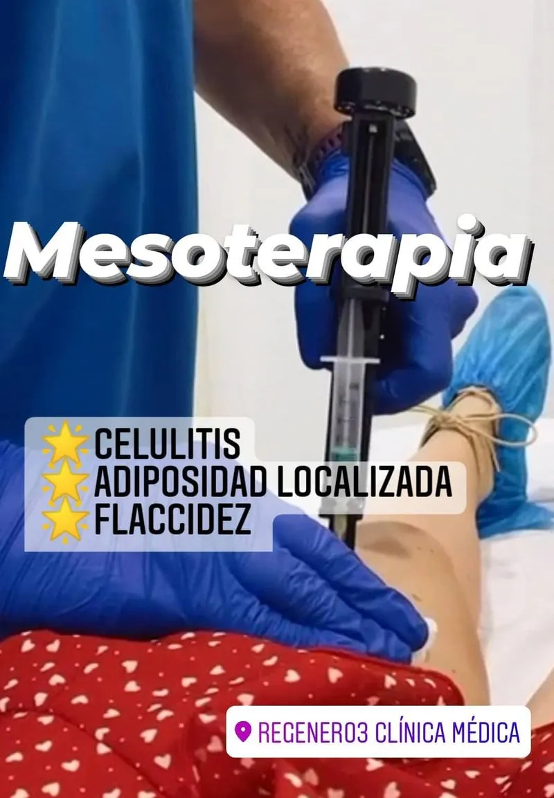 mesoterapia en valencia